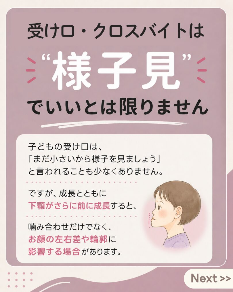 受け口やクロスバイトは様子見だけでよいとは限らない説明