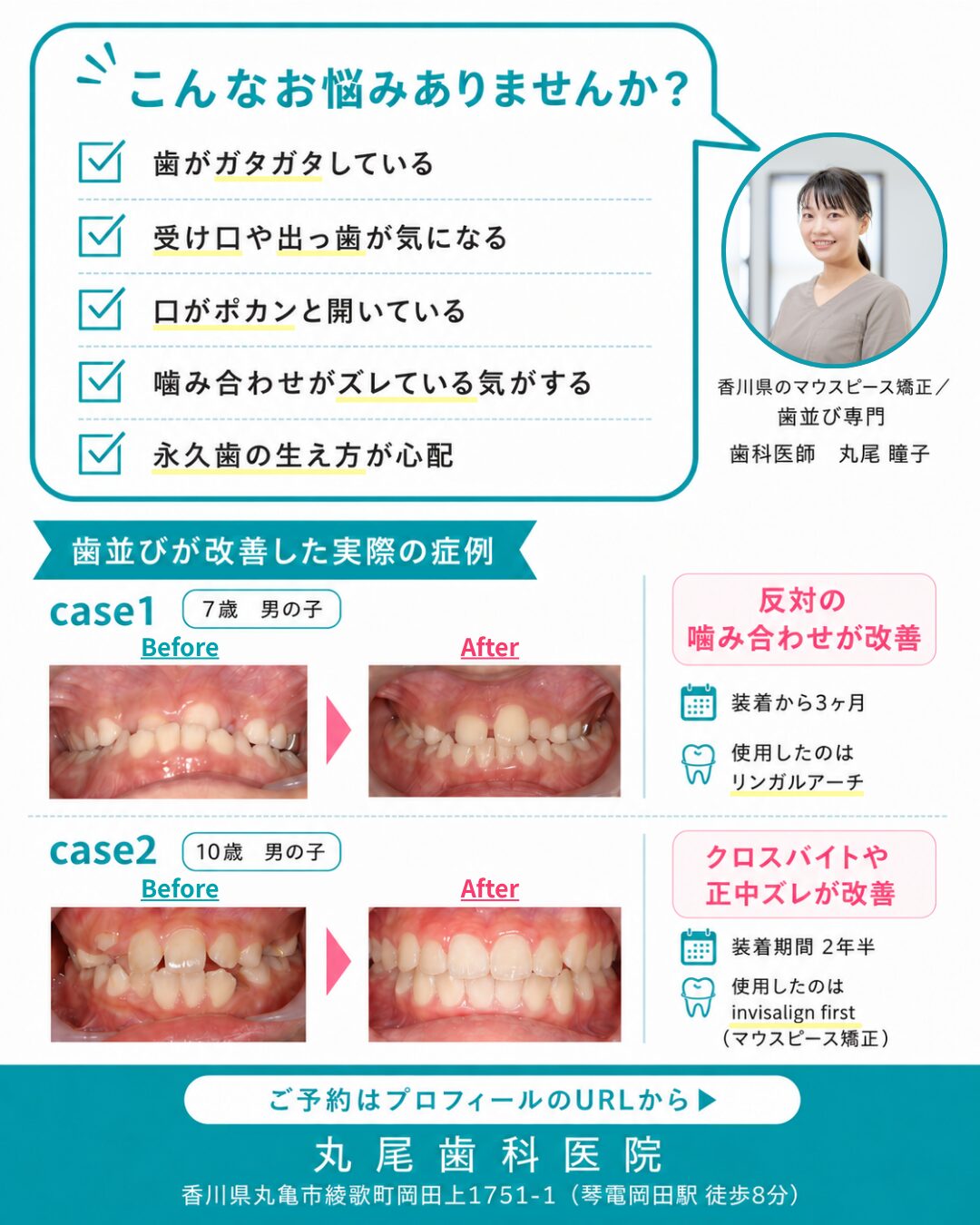 お子さまのお悩みと歯並び改善症例