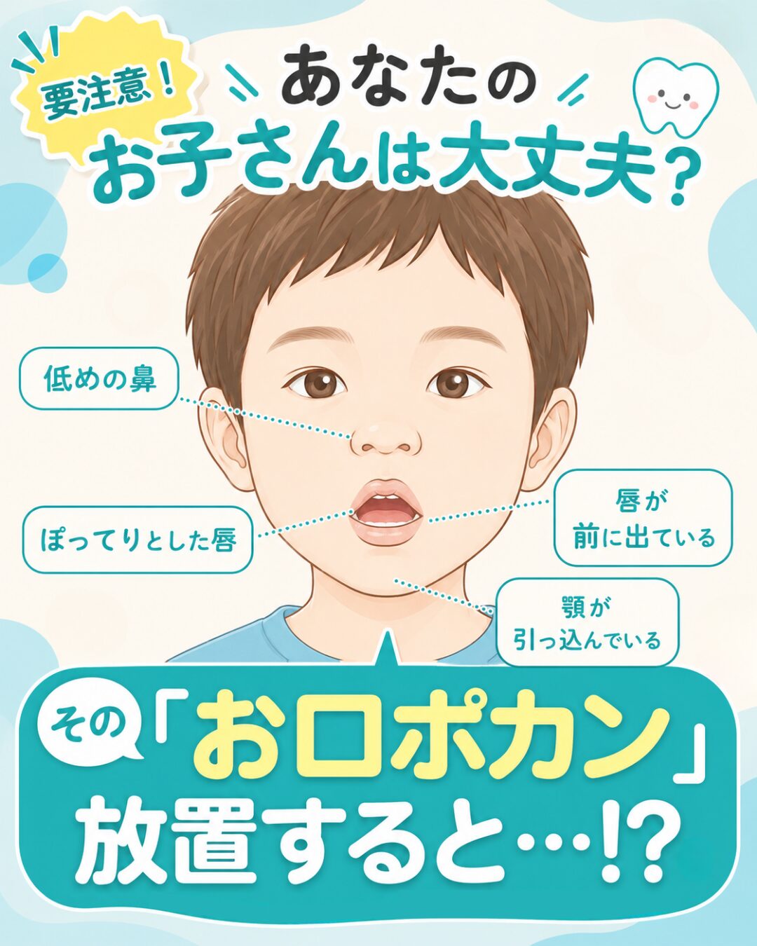 子どものお口ポカンを放置するとどうなるかの説明